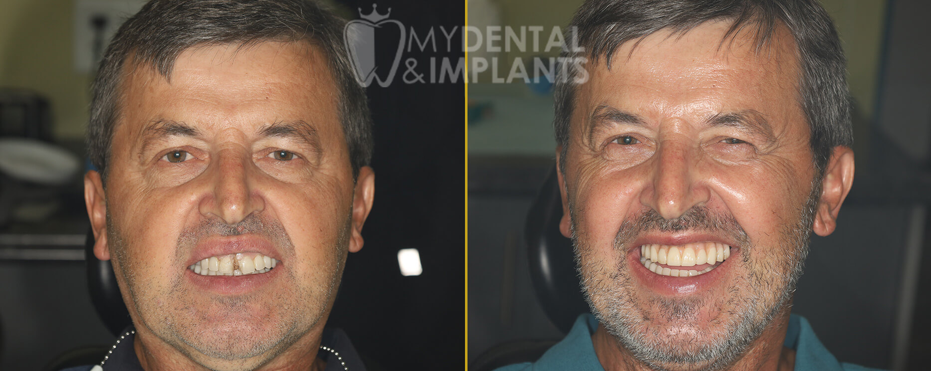 Before After Image